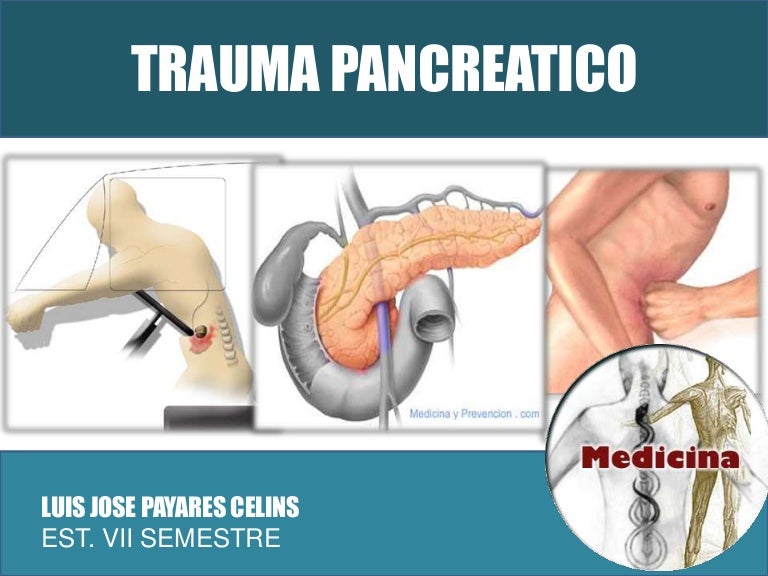 Cabeza llena de páncreas