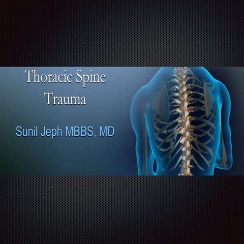 Imaging of thoracic spine Trauma