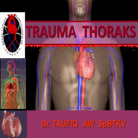 TRAUMA THORAKS DR TAW RSPAD1.ppt