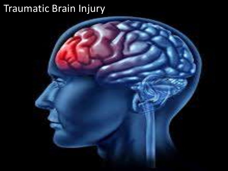 Brain injury