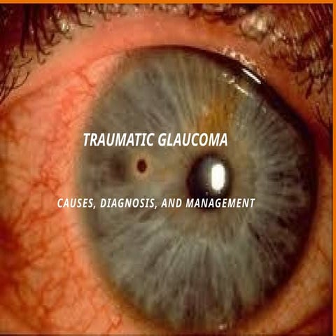 Traumatic_Glaucoma_Presentation Medical education.pdf.pptx.pptx