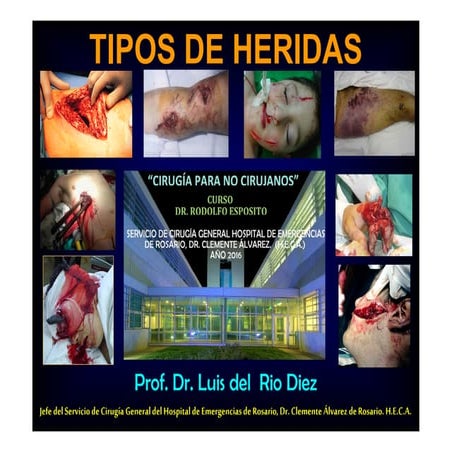HERIDAS, TRAUMATISMOS. ANESTÉSICOS LOCALES Y TIPOS DE CIERRES. Prof. Dr. Luis...