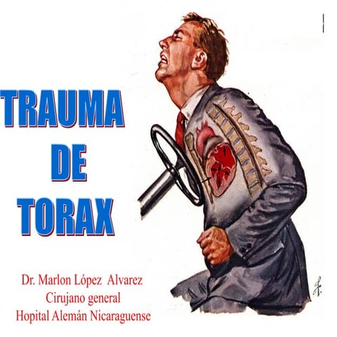 Torax inestable | PDF