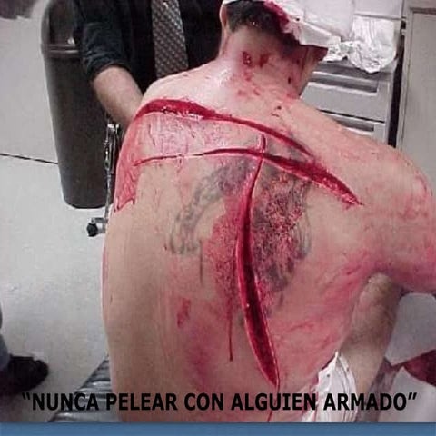 Trauma Tórax ESM IPN ATLS