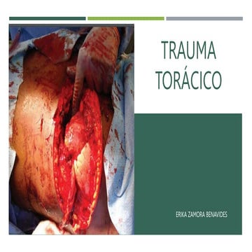 TRAUMA TORÁCICO SEGÚN ATLS. GUÍA 2023 . MEDICINA