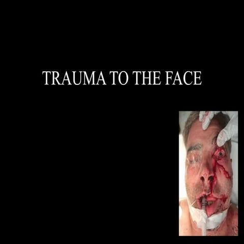 Trauma to the face
