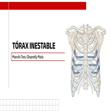 Tórax Inestable | PDF