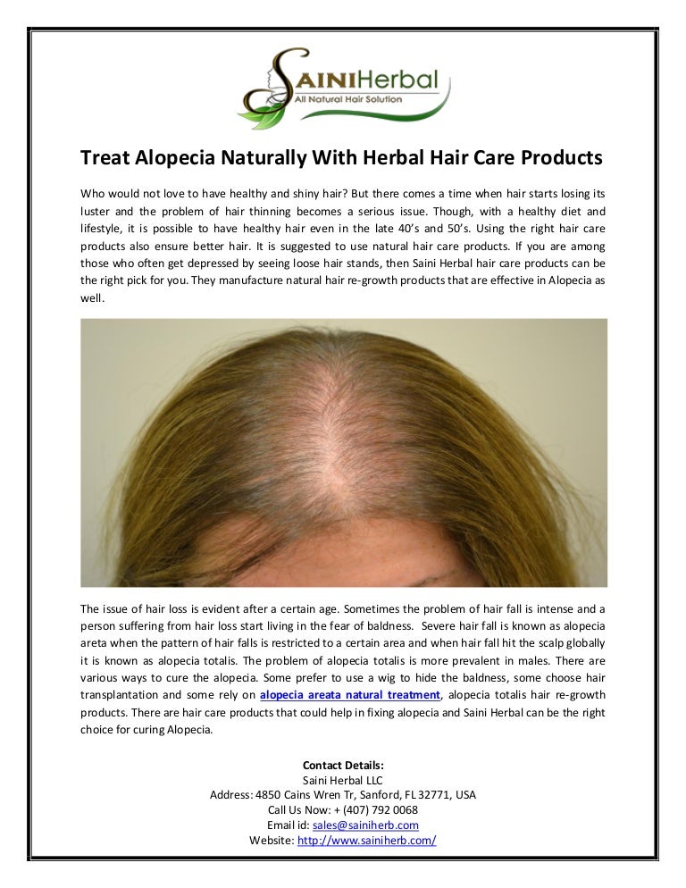 Treat alopecia naturally with herbal hair care products