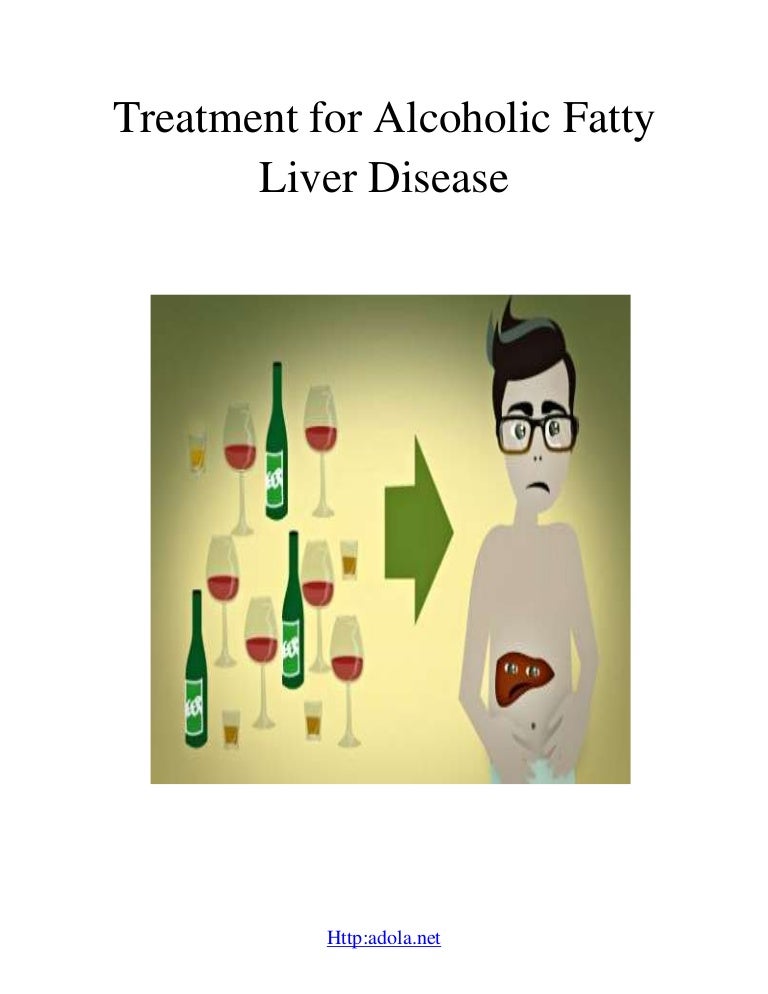 How to treat alcoholic fatty liver disease?