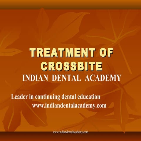 Treatment of crossbite   /certified fixed orthodontic courses by Indian   den...