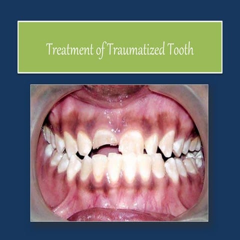 Treatment of traumatised tooth