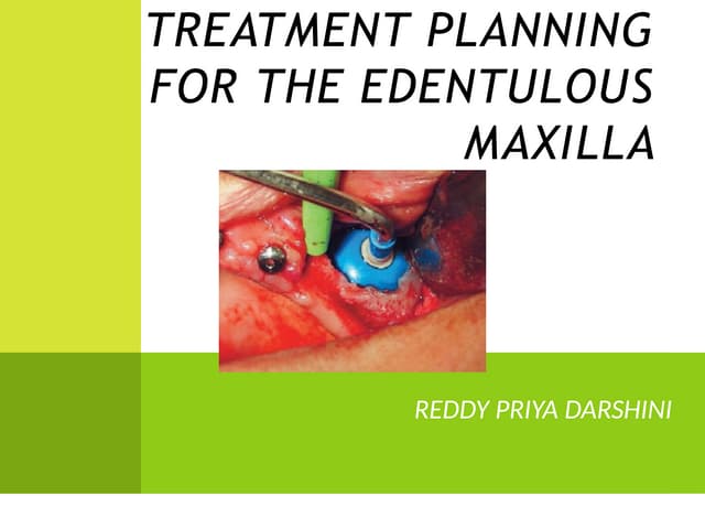 Treatment planning for the edentulous maxilla.pptx