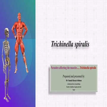 trichnella spiralis.pptx
