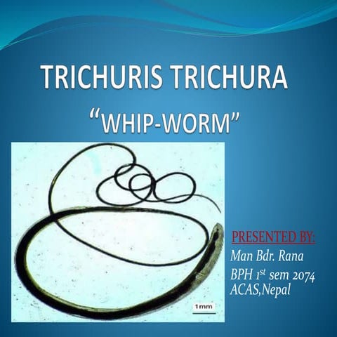 Trichuris trichura(whip-worm)