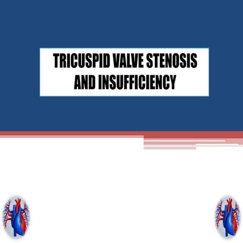 Tricuspid valve stenosis