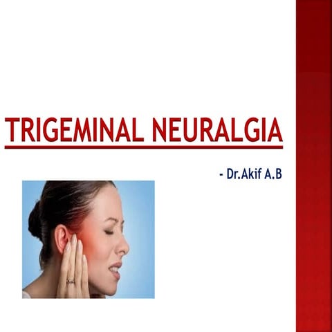 Trigeminal neuralgia