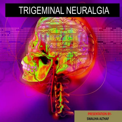 Trigeminal neuralgia