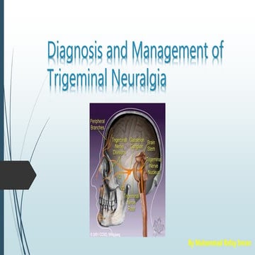 Trigeminal neuralgia 