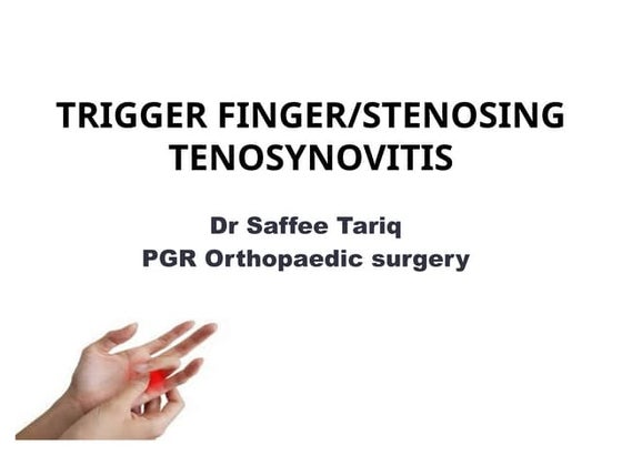 TRIGGER FINGER.pptx