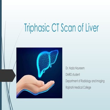 Triphasic CT Scan of Liver radiology.pptx