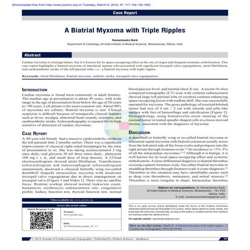 Tripple ripples of a biatrial myxoma