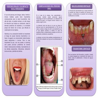 PIERCING EN ODONTOLOGIA