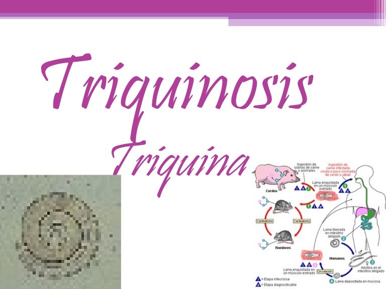triquinosis slideshare