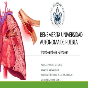 Tromboembolia pulmonar (TEP)