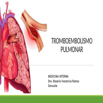 TROMBOEMBOLISMO PULMONAR  DIAPOSITIVAS..