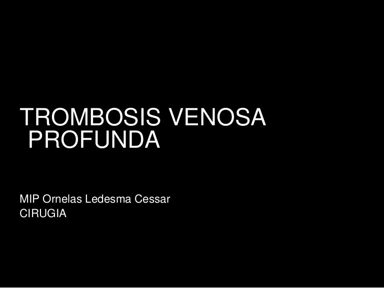 De o código r para / diagnóstico dvt de