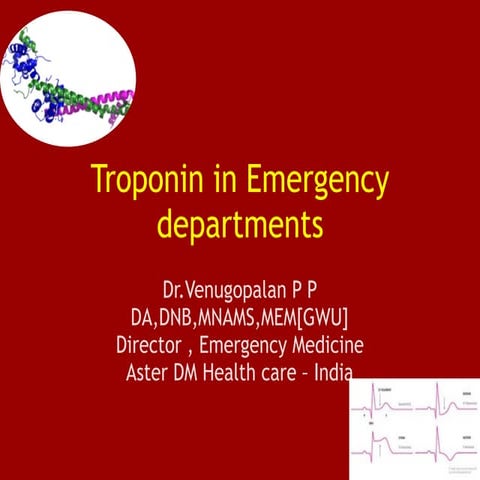 Troponins in emergency departments by venu