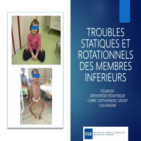 French Functional Method for Congenital Clubfoot: 20 years of ...