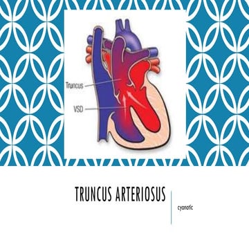 Truncus arteriosus