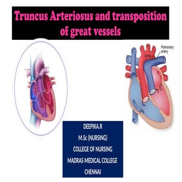 Truncus Arteriosus.cardiothoracic pptx ..