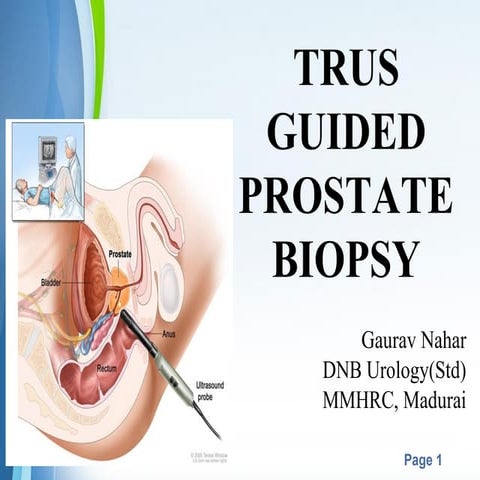 Trus biopsy prostate