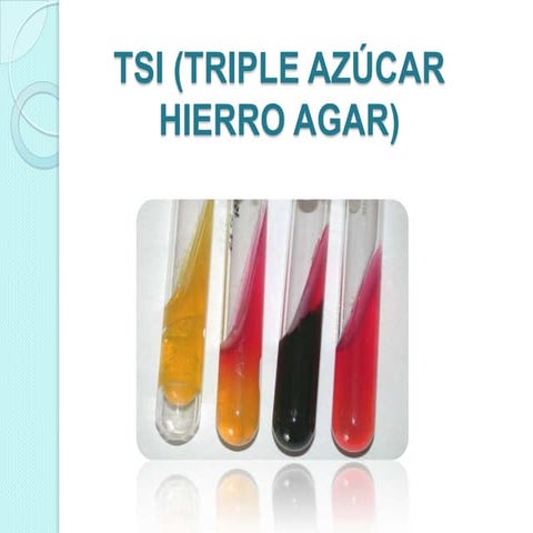 Tsi (triple azúcar hierro agar)