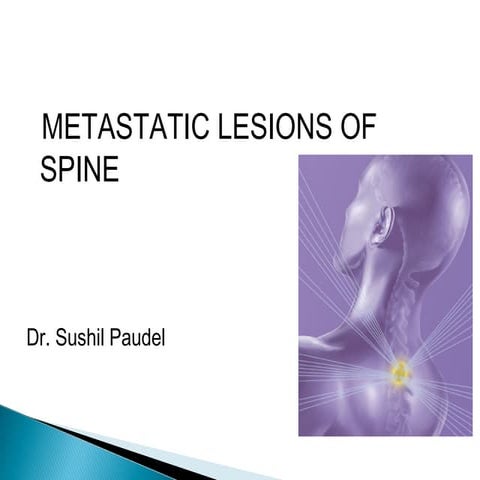 Metastases of spine