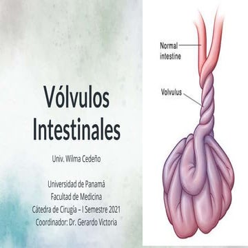Volvulos intestinales | PPTX