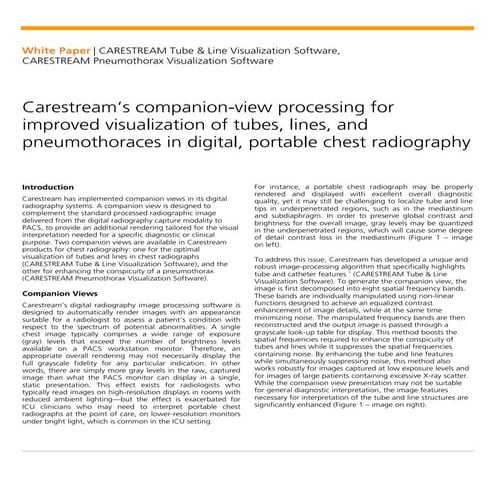 Tube and Line and Pneumothorax Visualization Software