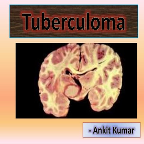 Tuberculoma