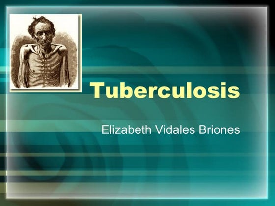 Tuberculosis | PPTX | Lung and Respiratory Health | Diseases and Conditions