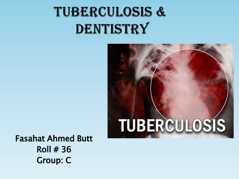Tuberculosis and dentistry