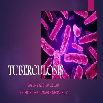 Tuberculosis