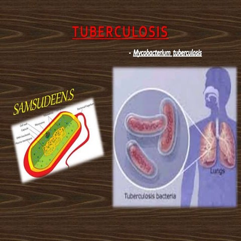 Tuberculosis