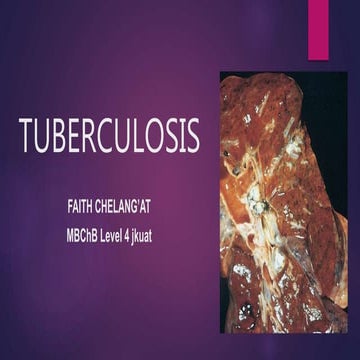 Tuberculosis by Faith Chelang'at