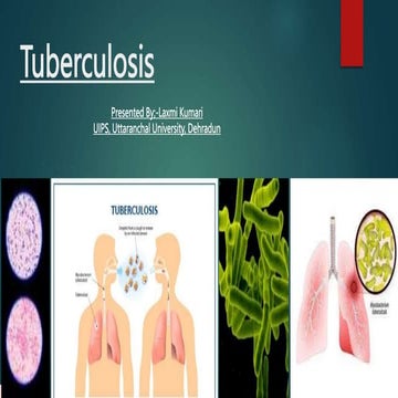 Tuberculosis.pptx
