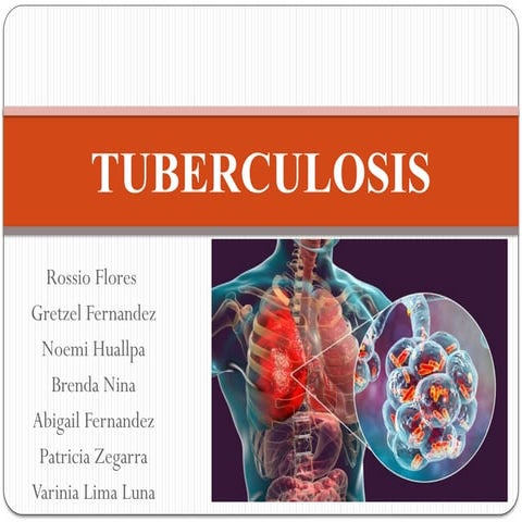 PRESENTACION POWER POINT DE TUBERCULOSIS | PPTX