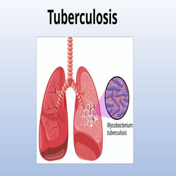 1. TERAPIA PREVENTIVA TUBERCULOSIS MINSA | PPTX