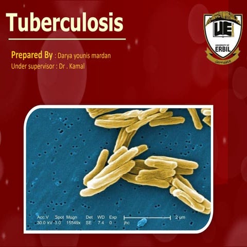 Tuberculosis presentation | PPT