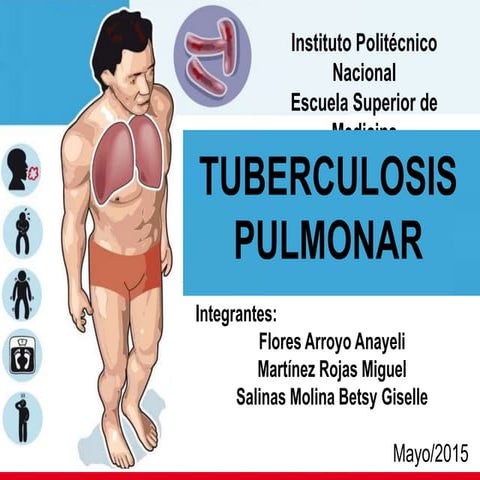 Tuberculosis pulmonar